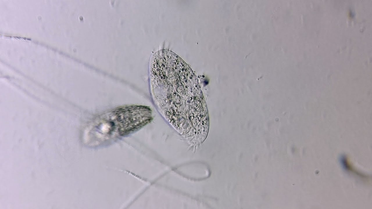 Stylonychia bitten by a Coleps - Caught on Camera