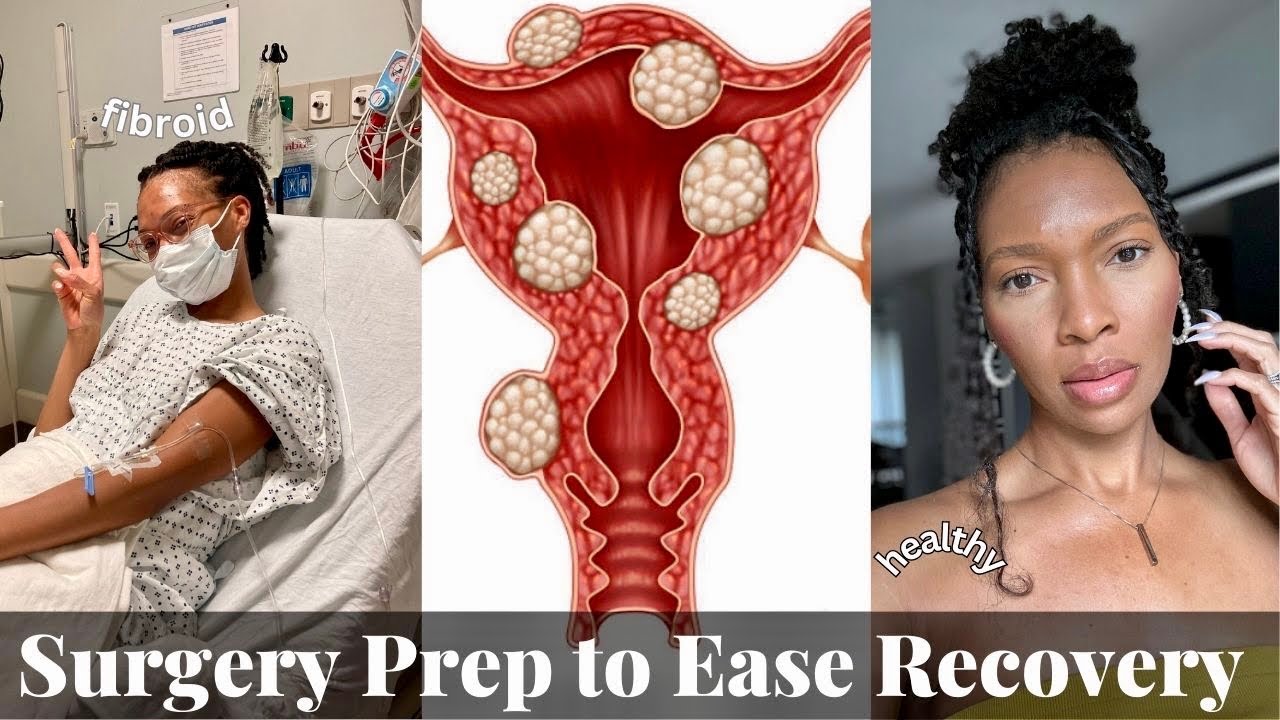 Another Day, Another Surgery: Fibroid (Myomectomy) & Major Surgery Prep Vlog