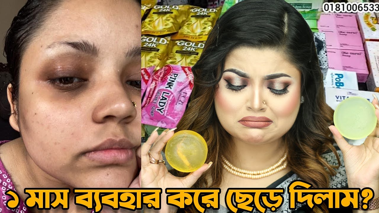 ত্বক ফর্সাকারী সাবান এক মাস ব্যবহারের পর ছেড়ে দিয়ে যা হল......