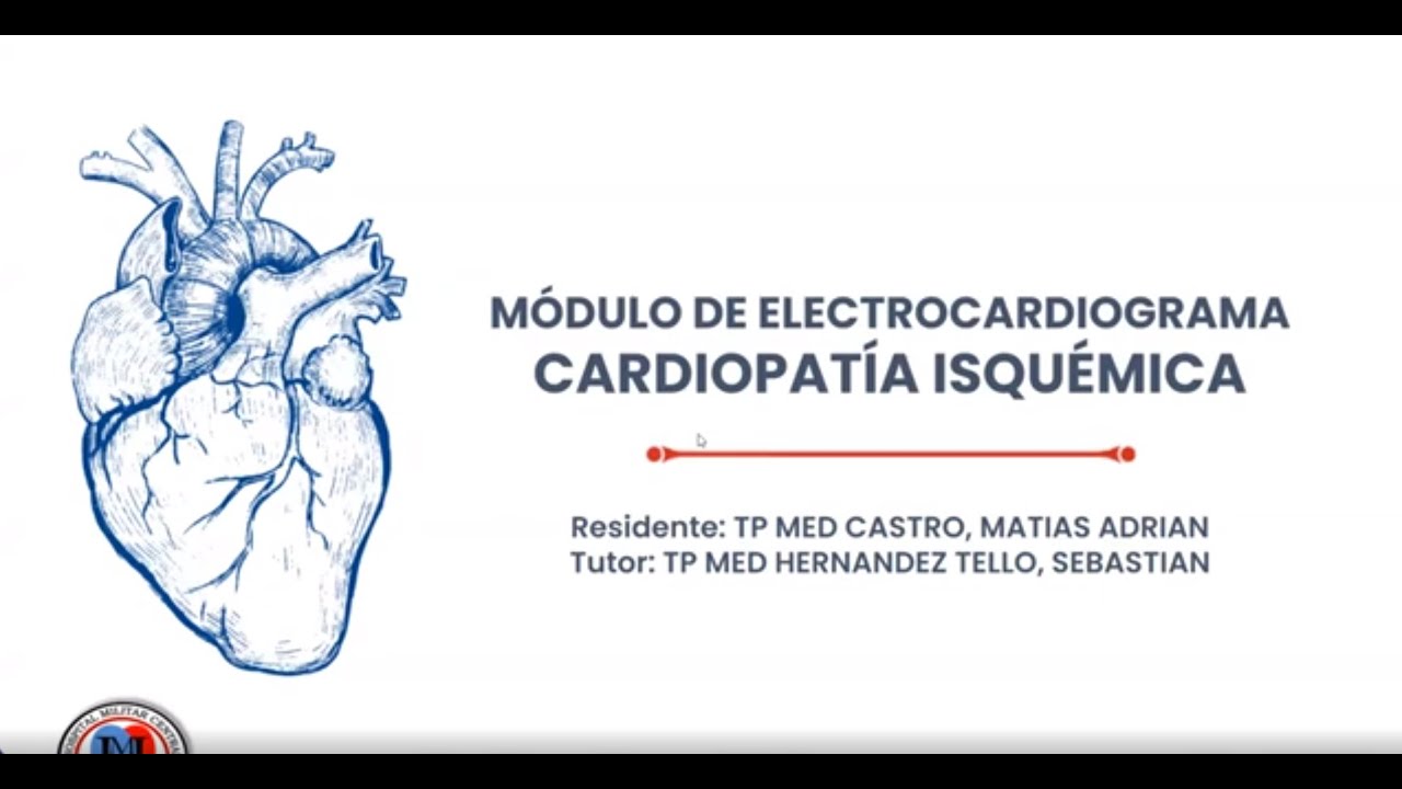 Electrocardiograma en cardiopatía isquémica