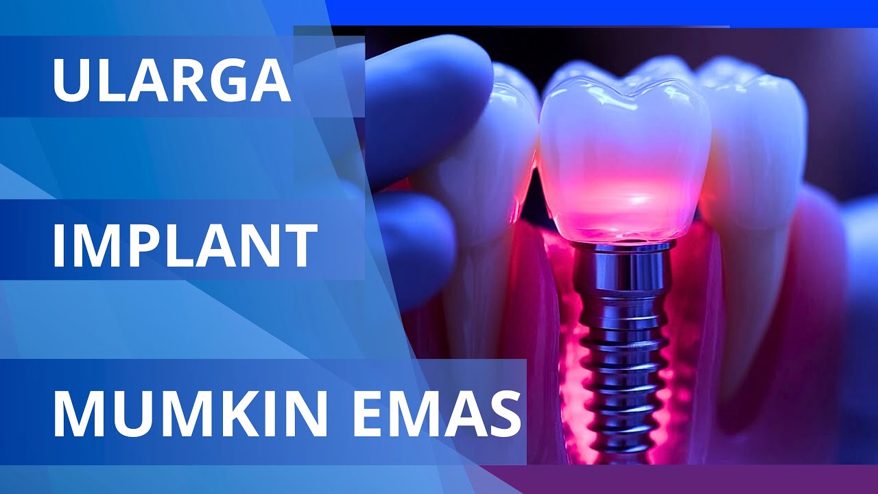 ULARGA IMPLANT QUYMASLIK KERAK 2025 FARRUKH DENTAL CLINIC