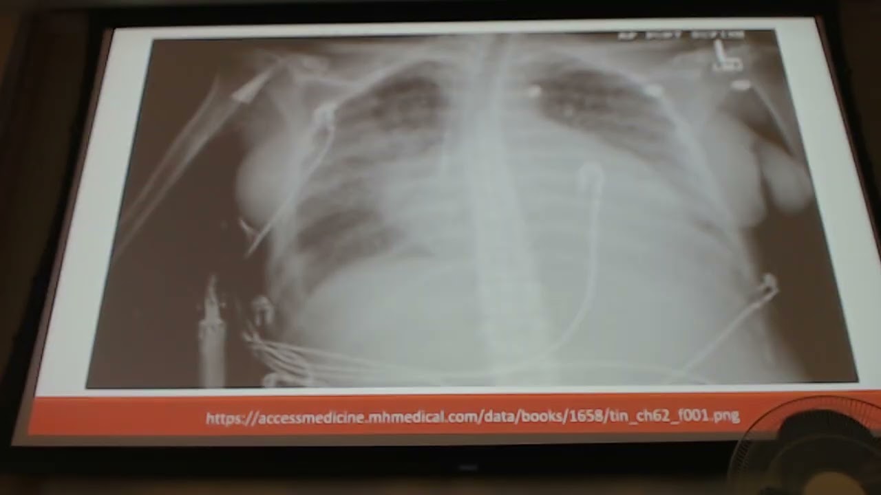 EMED block 2 Lecture 1