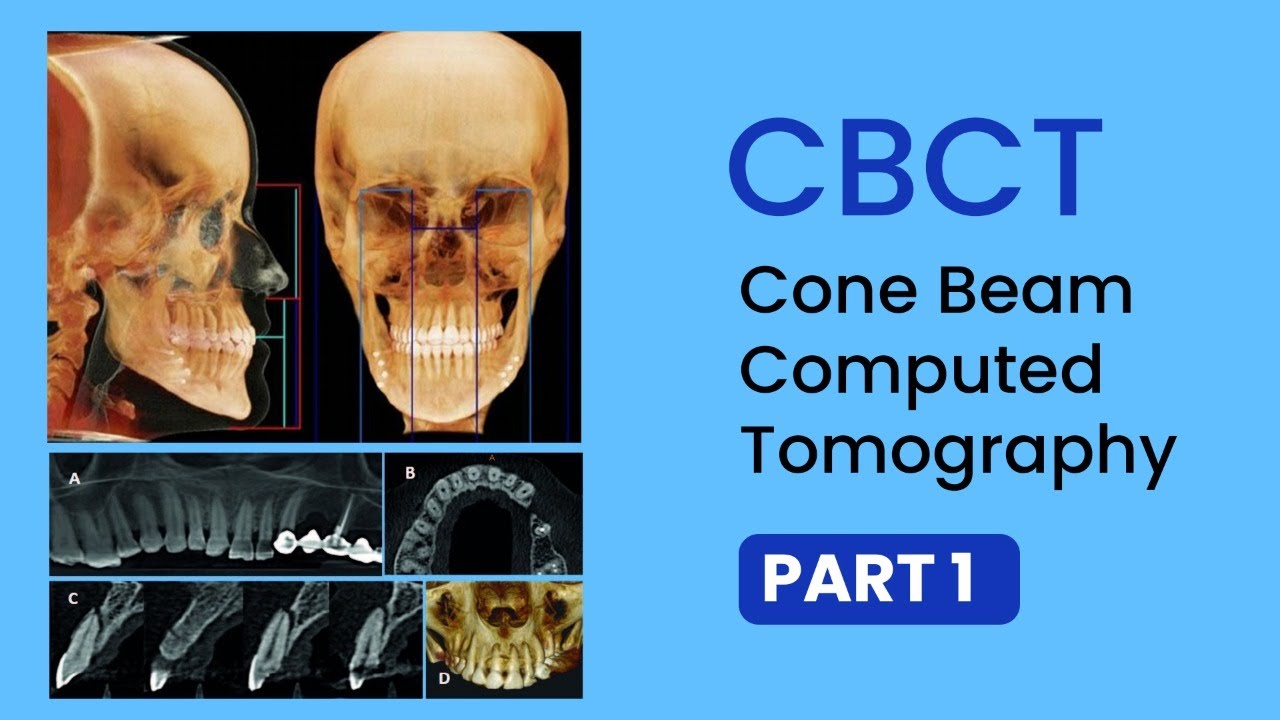 Read CBCT part 1 - Basics, Uses, Interpretations, Technical terms of Cone Beam CT #Scan