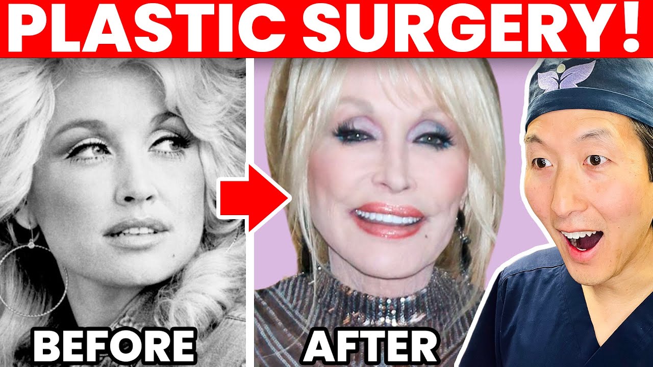 DOLLY PARTON'S Cosmetic Surgery Transformation!