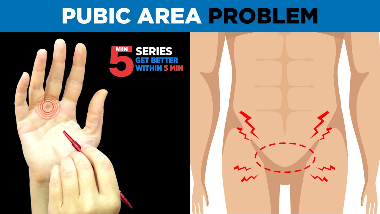 SUJOK TREATMENT FOR Pubic Area Problem 😣🔥🔥🔥(ON RIGHT HAND)