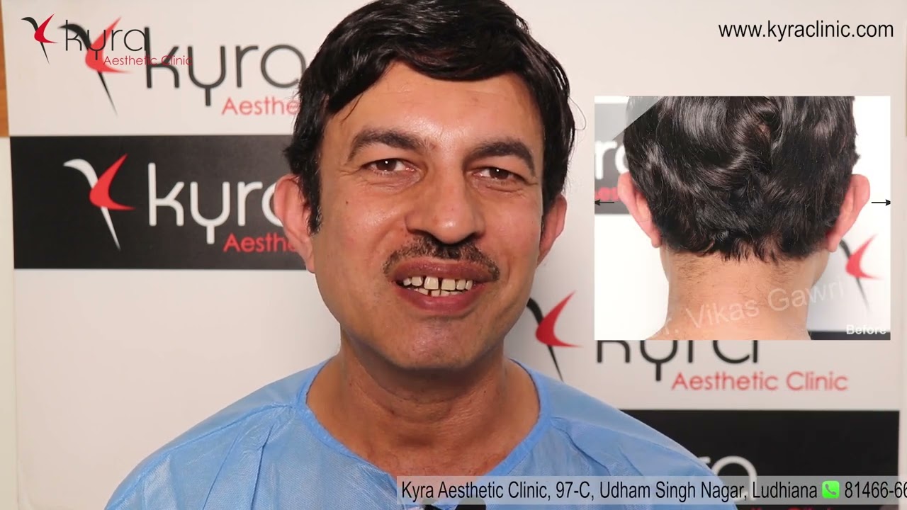 Otoplasty Actual Patient Results - Kyra Aesthetic Clinic