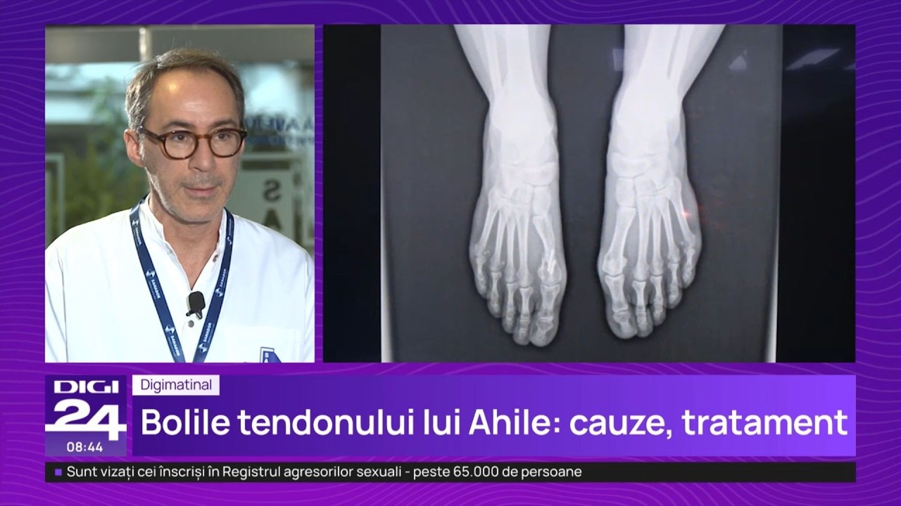 Bolile tendonului lui Ahile – Dr. Codrin Huszar | Spitalul Clinic SANADOR