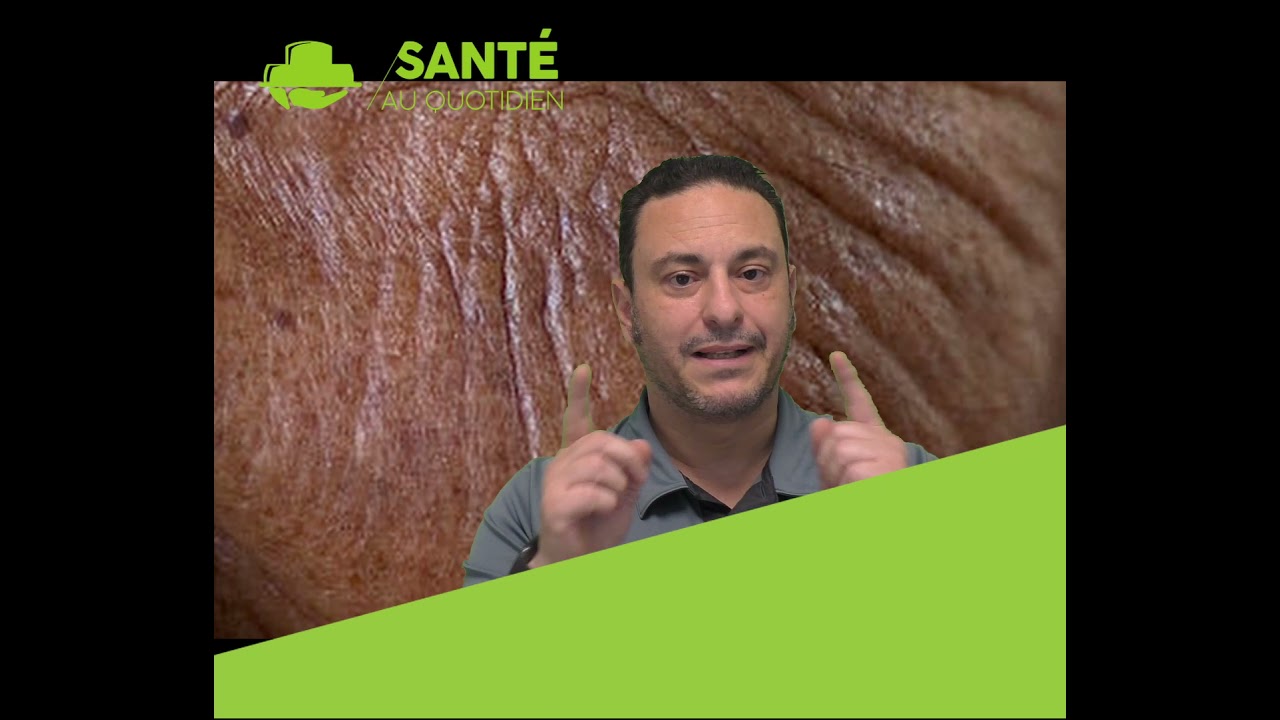GLYCATION = DANGER LE SUCRE EST UN AMI MORTEL POUR L'HOMME