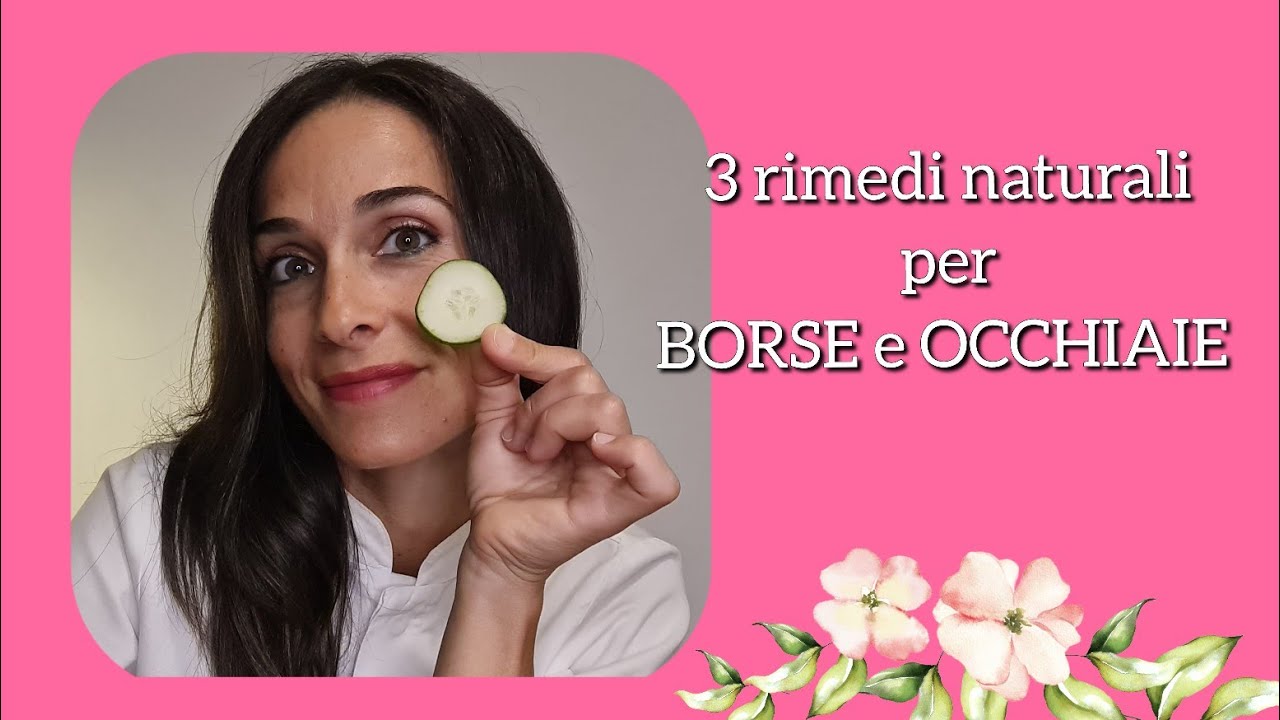Borse e occhiaie rimedi naturali