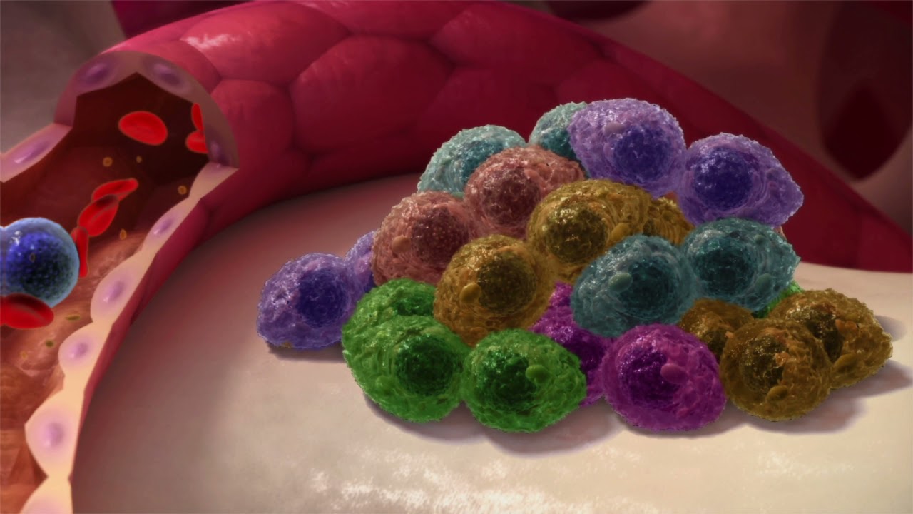 Myeloma UK Clonal evolution in myeloma