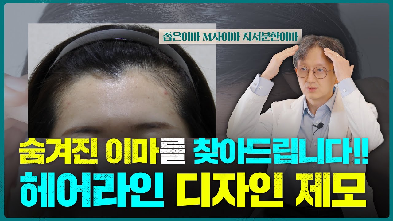 예쁜이마 만드는 방법! (좁은이마 헤어라인제모)