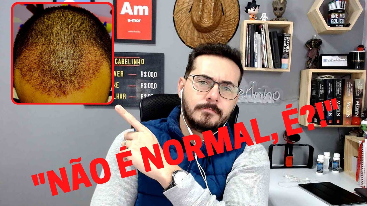 SENSIBILIDADE E VERMELHIDÃO NA ÁREA RECEPTORA APÓS O TRANSPLANTE CAPILAR - VAI VOLTAR AO NORMAL???