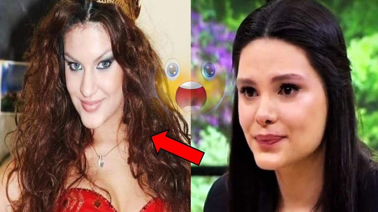 Estetikli Ünlüler