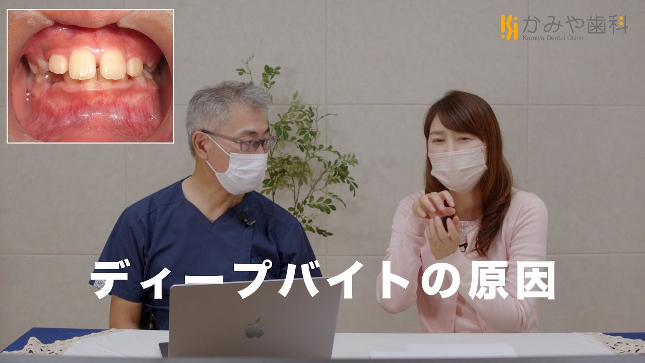 ディープバイト（過蓋咬合）上前歯が覆いかぶさっている噛み合わせ