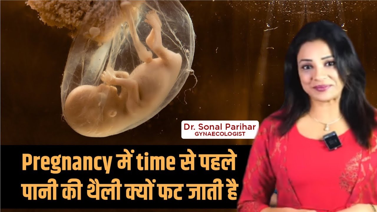 Decoding the Mystery: जानिए Pregnancy में समय से पहले थैली फटने का कारण | Dr. Sonal Parihar