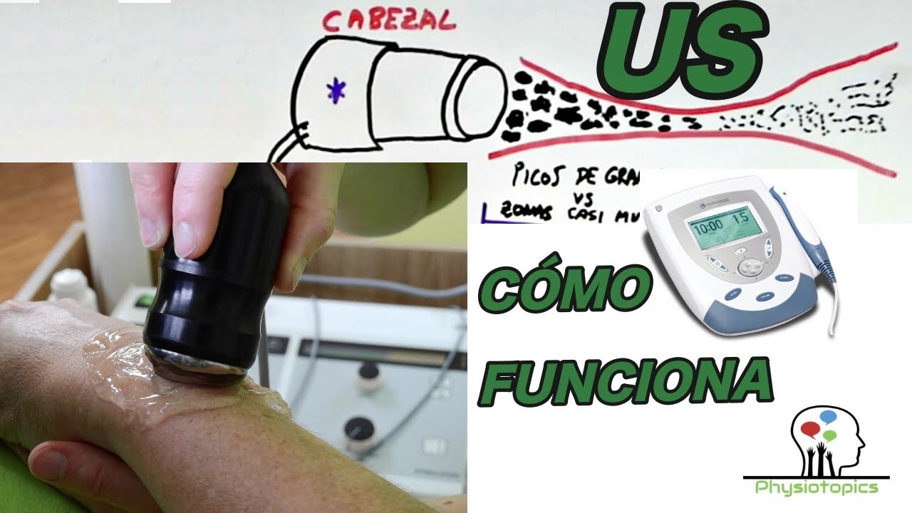 Ultrasonido Terapéutico (explicado)