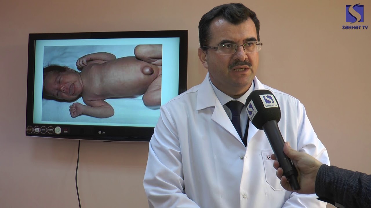 Uşaqlarda qalxanabənzər vəziləri (zobun) əlamətləri..