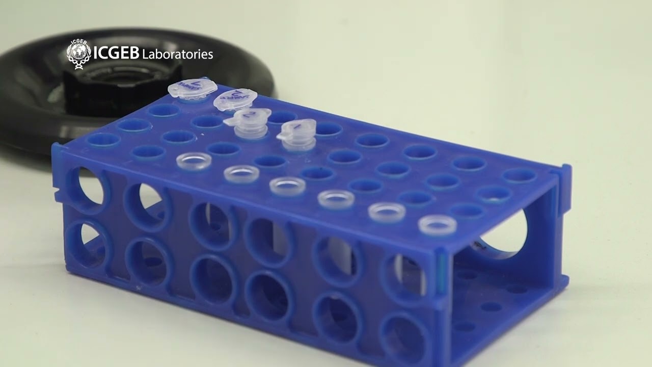 RNA extraction using Qiagen Qlamp Viral RNA Kit