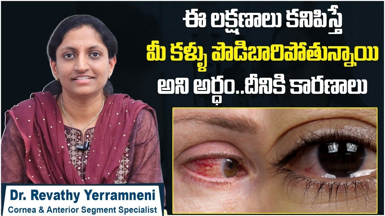 మీ కళ్ళు పొడిబారిపోతున్నాయా? || Symptoms and Causes Of Dry Eyes || Smartvision Eye Hospitals