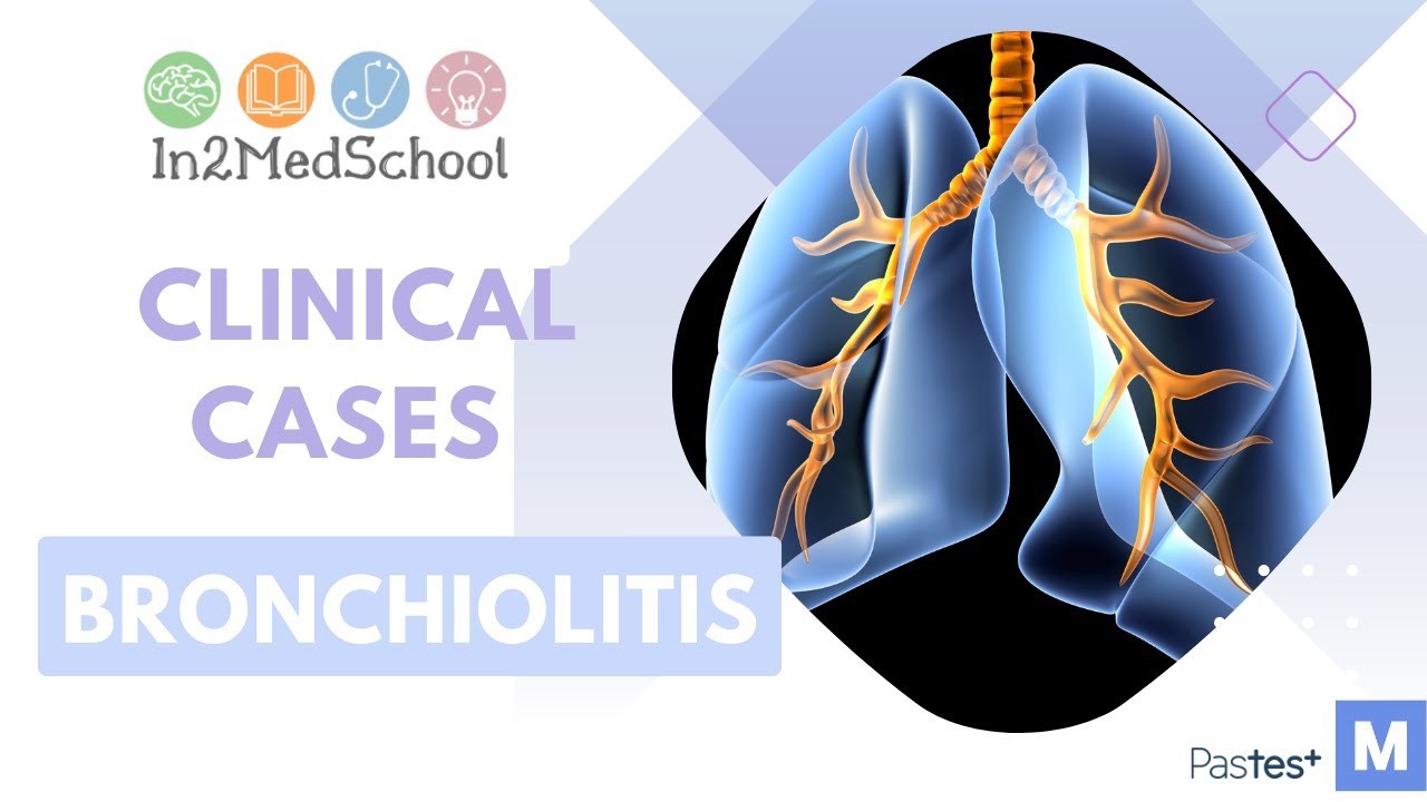 Bronchiolitis Clinical Case