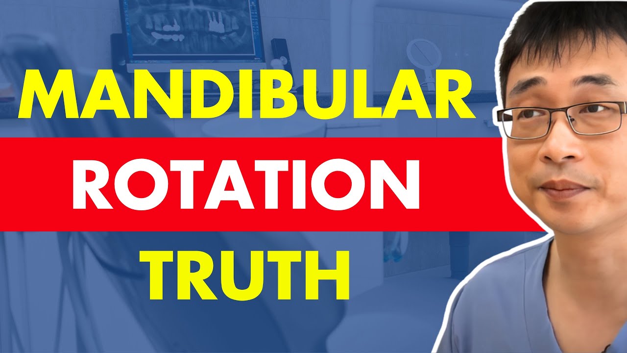 Live Q&A: The True Mandibular Rotation Explained: Why Most Dentists Get It Wrong
