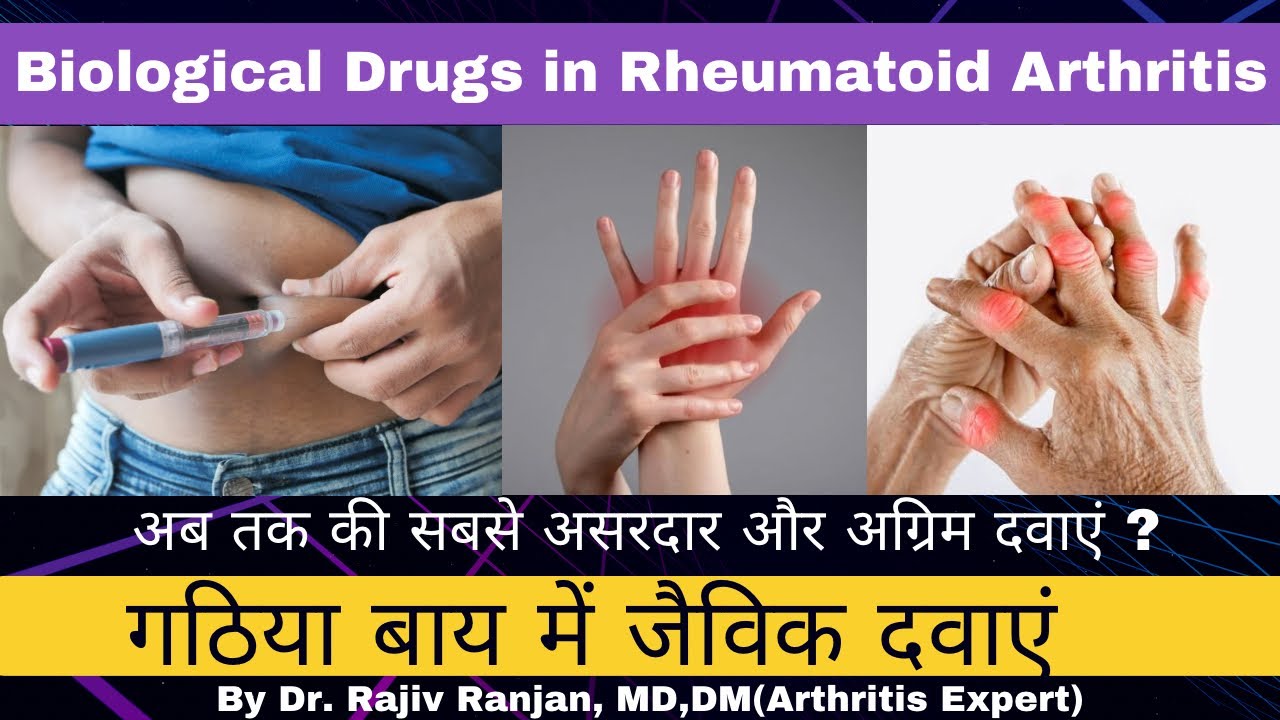 गठिया बाय का नया इलाज | Biological agents in Rheumatoid Arthritis