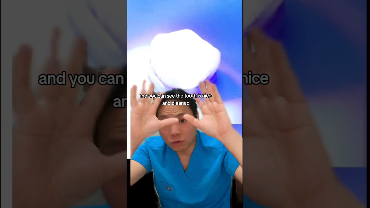 What is Inside a White Filling? #composite #filling #resin