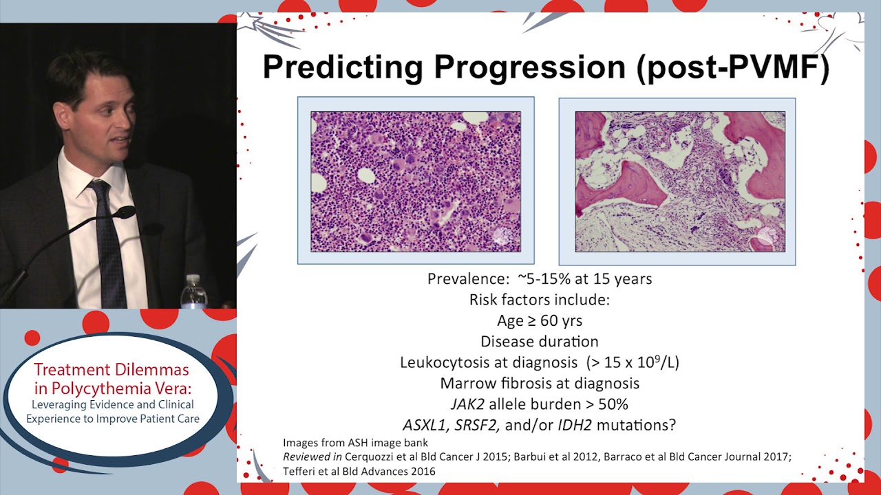 Prognostication and initiation of therapy in Polycythemia vera: Do we have it right?