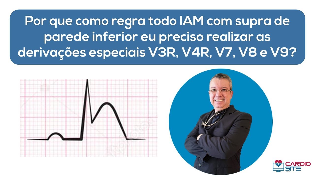 IAM com supra parede inferior. Por que são realizadas as derivações V3R, V4R, V7, V8 e V9?