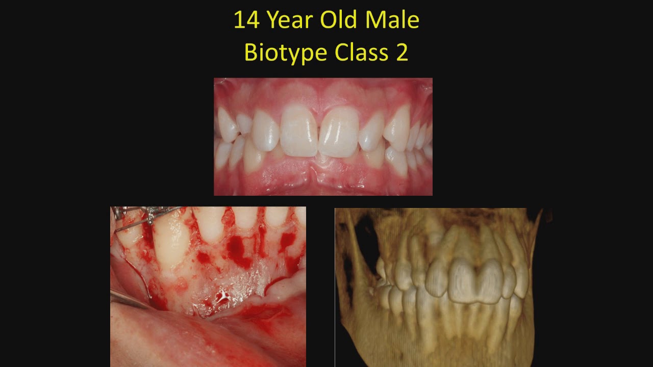 Biotype