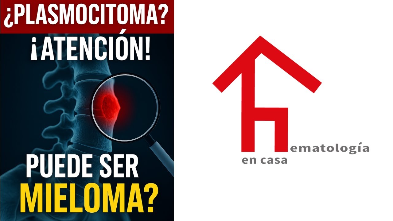 ¿Plasmocitoma Solitario? ¿Es cáncer? ¿Tiene cura? ¿Puede convertirse en mieloma múltiple?