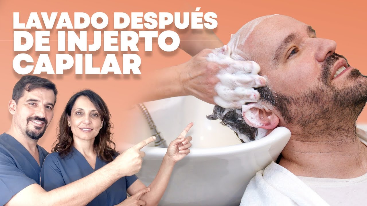 🔵 Cómo LAVARSE el pelo después de un INJERTO capilar 🚿 | Clínica Martínez Simón | Castellón