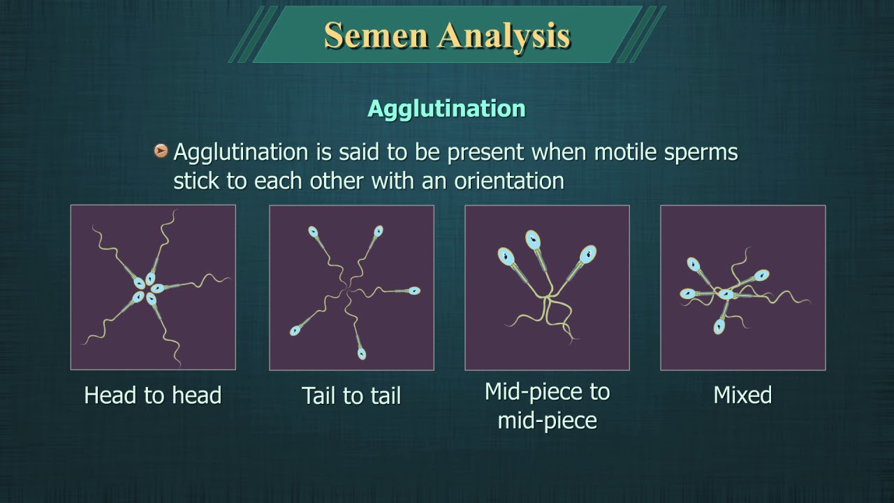Semen Analysis