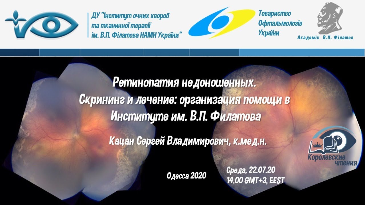 Ретинопатия недоношенных. Скрининг и лечение: организация помощи в  Институте им. В.П. Филатова