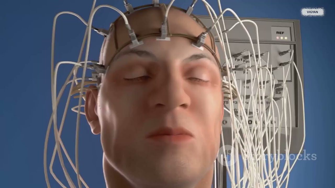 BrainGate: The Future of Thought-Controlled Tech