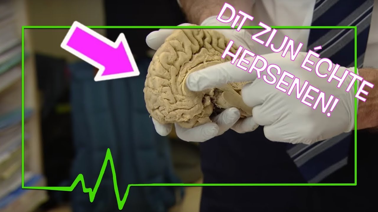 HOE LEER JE IETS?? - TOPDOKS ONDERZOEK HERSENEN