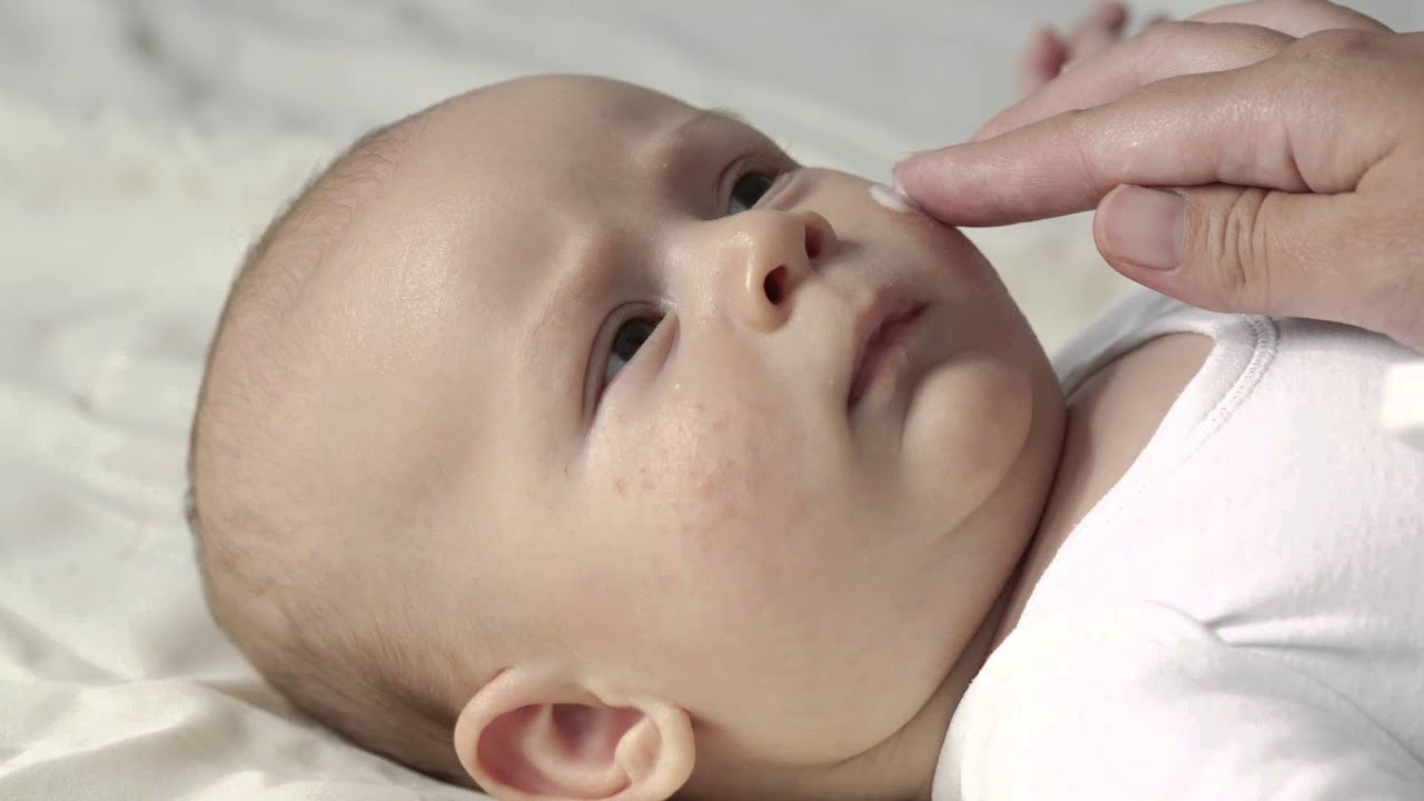 Winter Skin Care For Your Baby - Boys Town Pediatrics