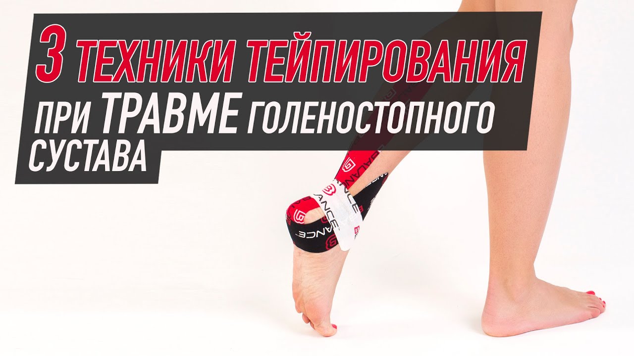 ✅ 3 техники тейпирования при травме голеностопного сустава | BBALANCE - учебный центр