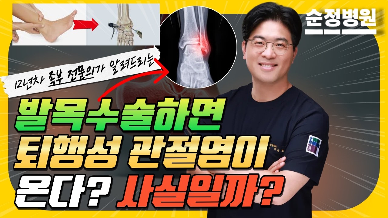 [12년 족부전문의 허순호 순정병원 병원장] 발목수술하면 퇴행성관절염? 발목에 물차면 빼야하나요? - 발목자주묻는질문 A to Z