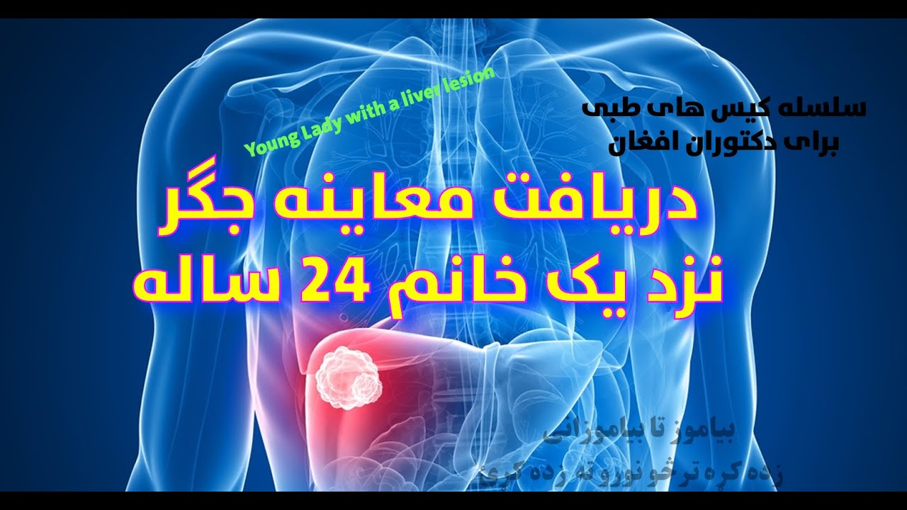 التراسوند در جگر این خانم جوان چی را نشان میدهد. کیس رادیولوژی برای داکتران با تشریح قدم به قدم