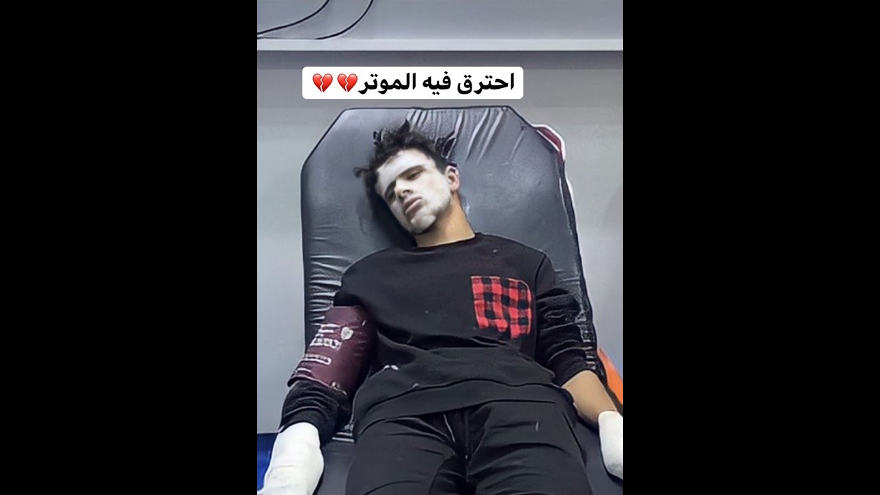 عادل الشراري بعد الحادث الذي كان سبب احتراقه و دخوله بغيبوبه