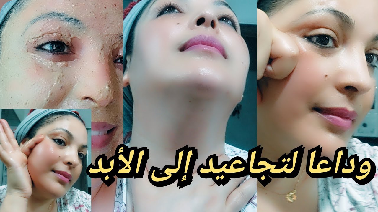 داومي على هذه الوصفة ومساج يومي أقسم لك ستخلصك من تجاعيد الوجه كأنك في20من عمرك مجربة ومضمونة 💯