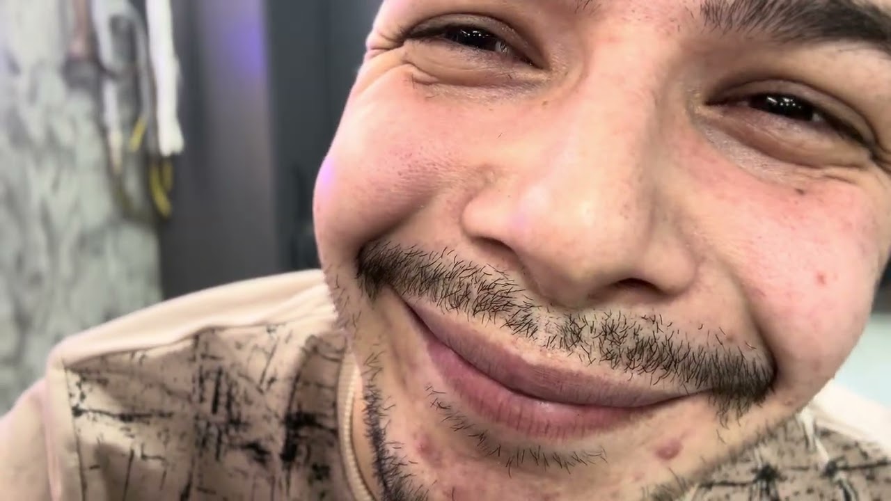 Protezi önce taktık sonra kestik #keşfetteyiz #turkey #ytdayibenionecikarnolur 