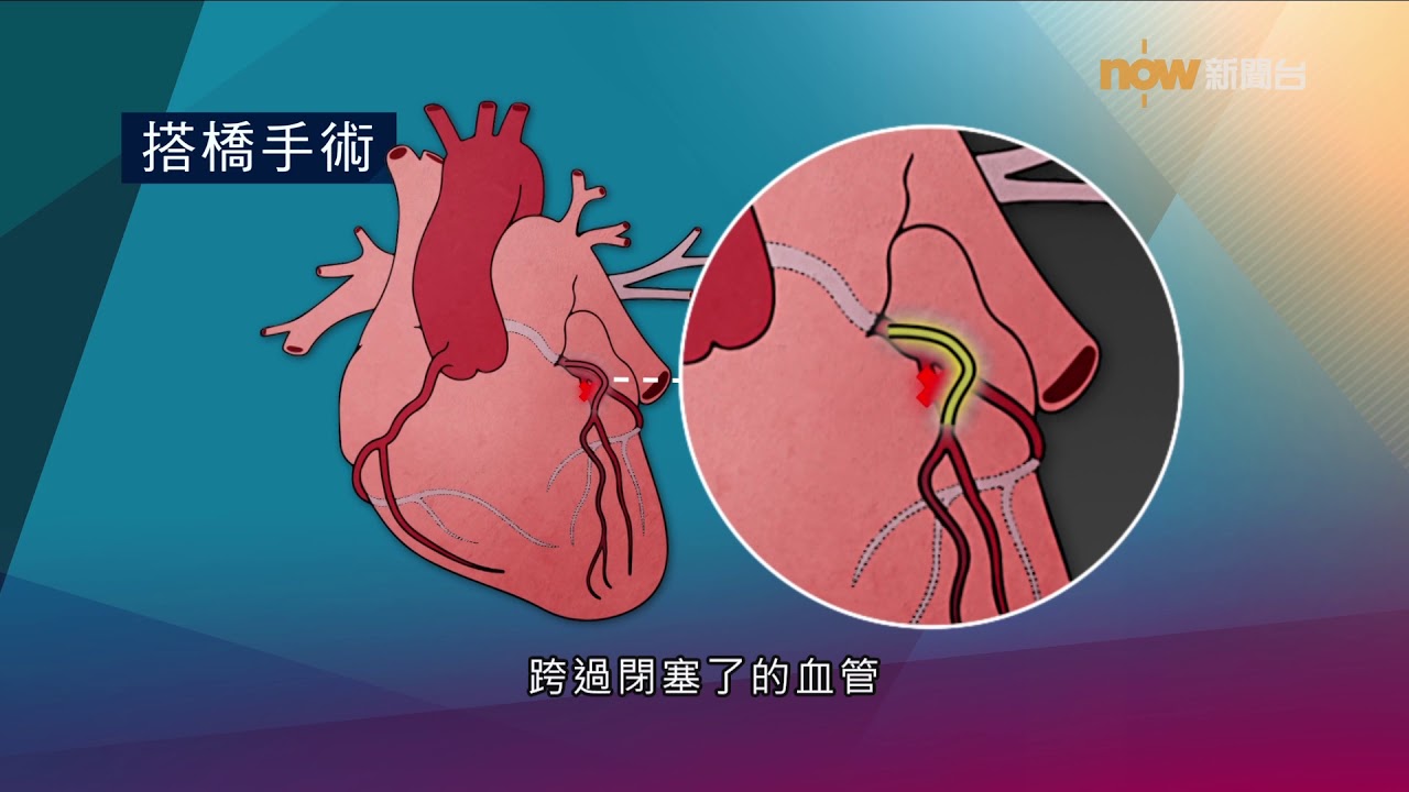 【杏林在線】通心術