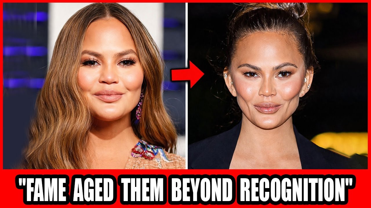 Hollywood’s Most Regretted Surgery — Faces That Aged 20 Years Overnight!