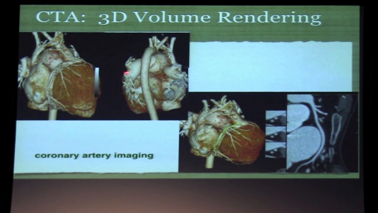 The Pros & Cons of Cross-Sectional Imaging in ACHD - Dr. Pierangelo Renella | 2017 UCLA ACHD