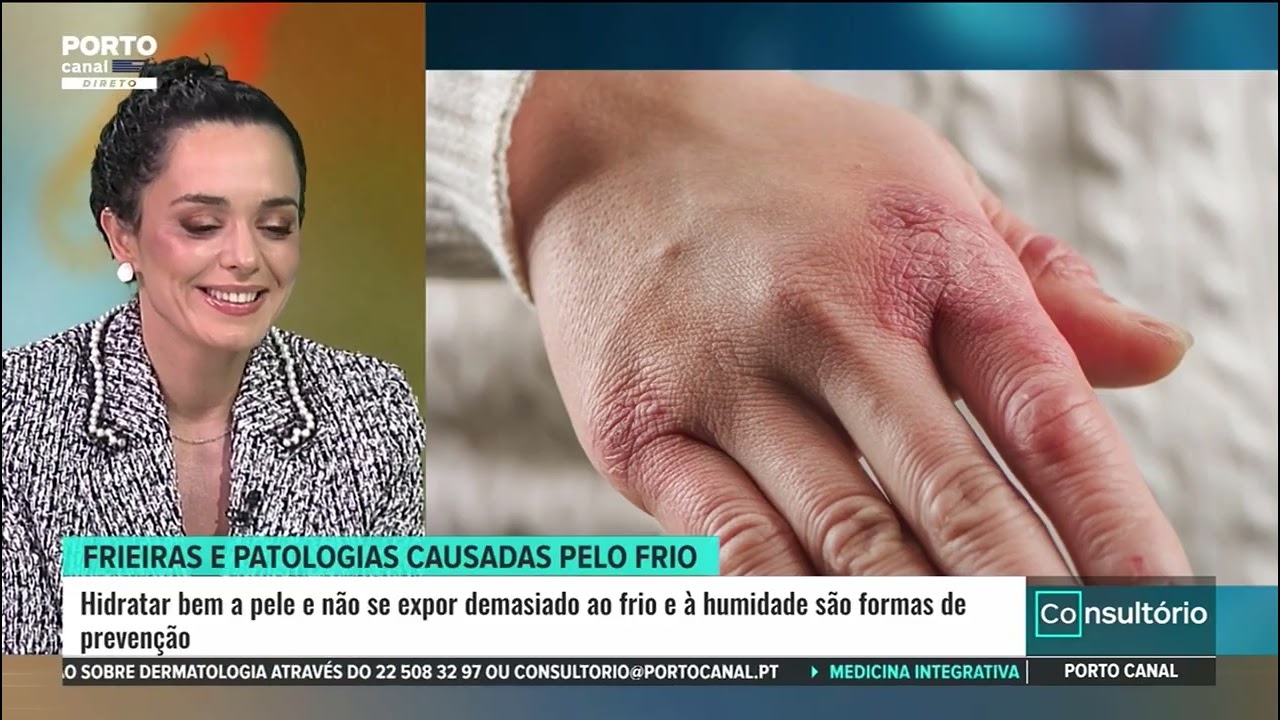 Frieiras e patologias causadas pelo frio | Dra. Marta Teixeira em entrevista ao Porto Canal