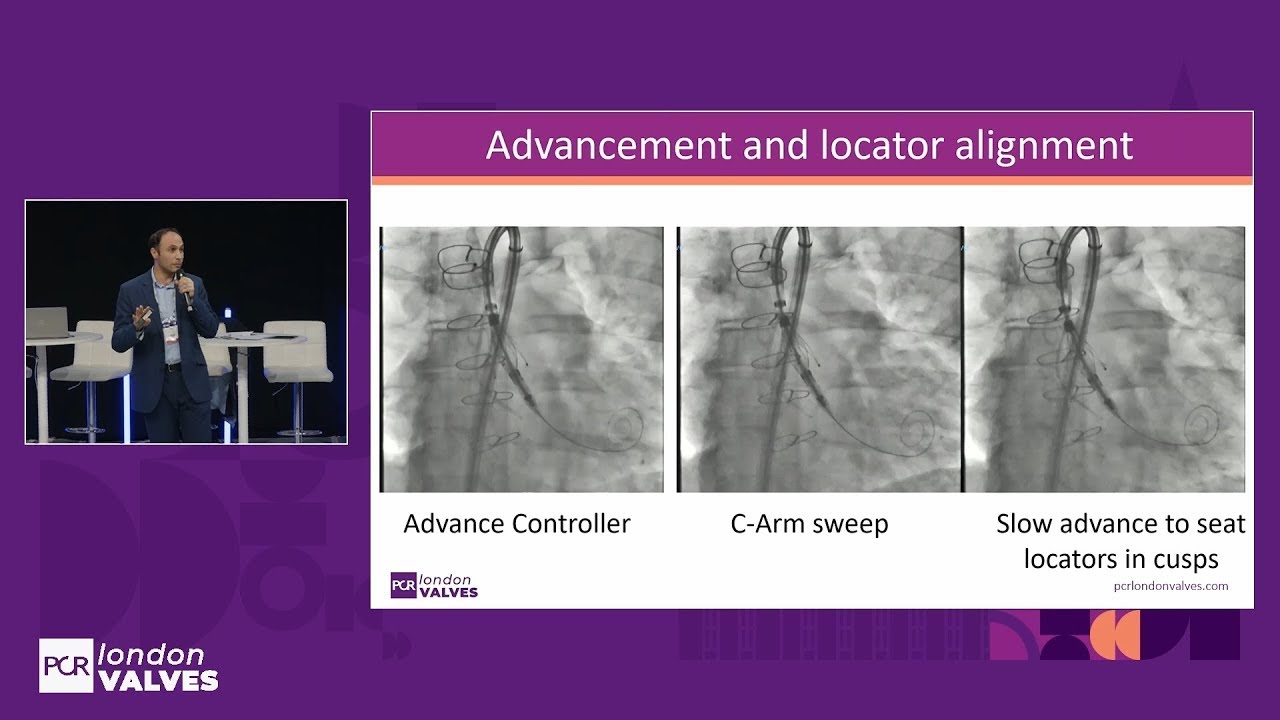 New era for aortic regurgitation: how new guidelines & AR-dedicated devices will redefine treatment