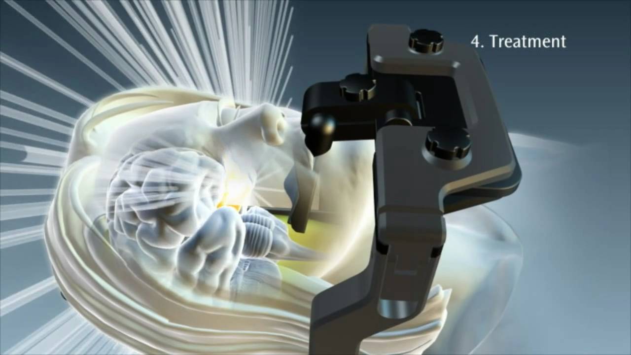 Elekta Axesse