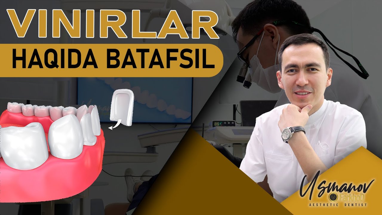 Vinirlar haqida batafsil